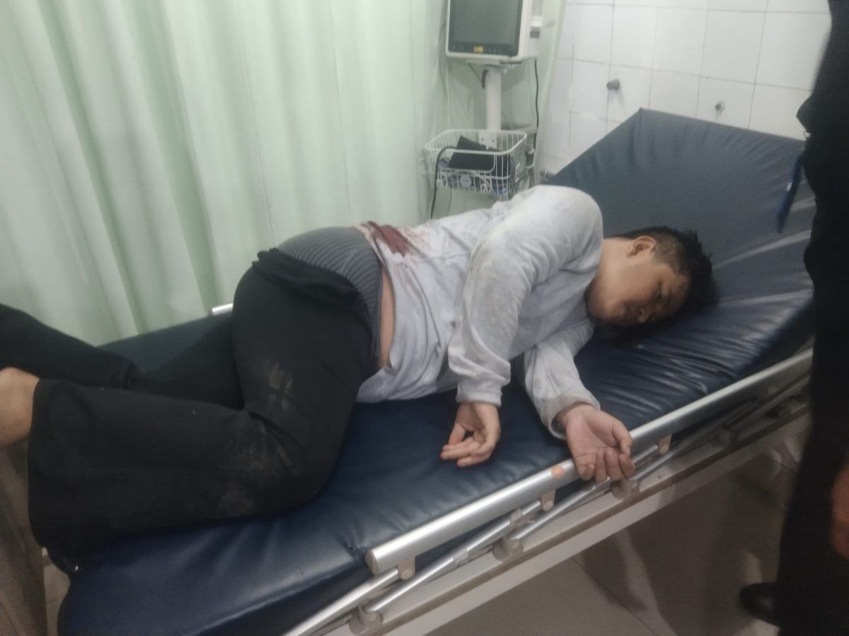 Sadis! Modus Tolong Korban Begal di Ciapus Berujung di Rampok, Korban Mengalami Luka Berat Akibat Luka Tusuk, Harta Benda Raib (dok, foto: Korban Perampokan Modus Baru)